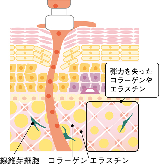 独自の波形と効果の高い60Vの組み合せで、美容成分を深層部まで導入可能！